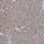 BCS1L Antibody in Immunohistochemistry (IHC)