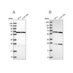 ACAD9 Antibody in Western Blot (WB)