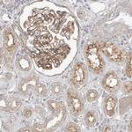 MAT2B Antibody in Immunohistochemistry (IHC)