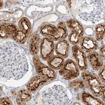 MAT2B Antibody in Immunohistochemistry (IHC)