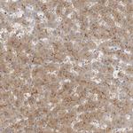 MAT2B Antibody in Immunohistochemistry (IHC)