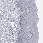 MAT2B Antibody in Immunohistochemistry (IHC)