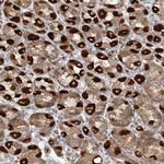 RAB11FIP2 Antibody in Immunohistochemistry (IHC)