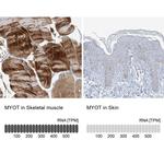 Myotilin Antibody in Immunohistochemistry (IHC)