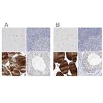 Myotilin Antibody in Immunohistochemistry (IHC)