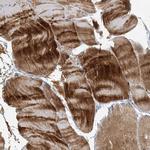 Myotilin Antibody in Immunohistochemistry (IHC)