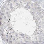 Myotilin Antibody in Immunohistochemistry (IHC)