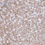 A1CF Antibody in Immunohistochemistry (IHC)