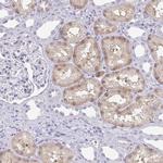 A1CF Antibody in Immunohistochemistry (IHC)