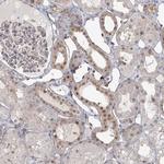 KBTBD4 Antibody in Immunohistochemistry (IHC)