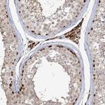 KBTBD4 Antibody in Immunohistochemistry (IHC)