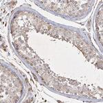 KBTBD4 Antibody in Immunohistochemistry (IHC)