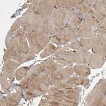 KBTBD4 Antibody in Immunohistochemistry (IHC)