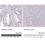 AKR1E2 Antibody in Immunohistochemistry (IHC)