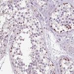 AKR1E2 Antibody in Immunohistochemistry (IHC)