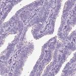 ARMC4 Antibody in Immunohistochemistry (IHC)