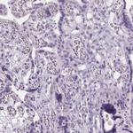 ARMC4 Antibody in Immunohistochemistry (IHC)