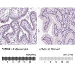 ARMC4 Antibody