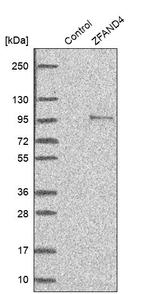 ZFAND4 Antibody in Western Blot (WB)