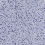 HORMAD1 Antibody in Immunohistochemistry (IHC)