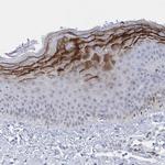 HORMAD1 Antibody in Immunohistochemistry (IHC)