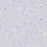 HORMAD1 Antibody in Immunohistochemistry (IHC)