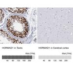 HORMAD1 Antibody