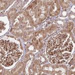 COPG Antibody in Immunohistochemistry (IHC)