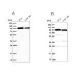 COPG Antibody in Western Blot (WB)