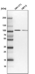 COPG Antibody in Western Blot (WB)