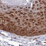 WAPL Antibody in Immunohistochemistry (IHC)