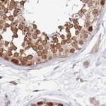 WAPL Antibody in Immunohistochemistry (IHC)