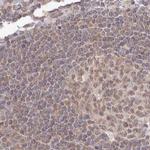 WAPL Antibody in Immunohistochemistry (IHC)