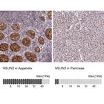 NSUN2 Antibody in Immunohistochemistry (IHC)