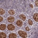 NSUN2 Antibody in Immunohistochemistry (IHC)