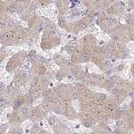 AAMDC Antibody in Immunohistochemistry (IHC)