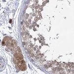 AAMDC Antibody in Immunohistochemistry (IHC)