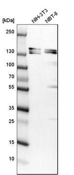 SH3PXD2A Antibody in Western Blot (WB)