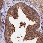 TAB182 Antibody in Immunohistochemistry (IHC)