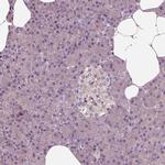 Shootin1 Antibody in Immunohistochemistry (IHC)