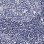 RTKN2 Antibody in Immunohistochemistry (IHC)