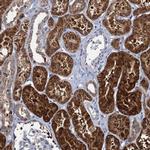 RTKN2 Antibody in Immunohistochemistry (IHC)