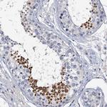 OLAH Antibody in Immunohistochemistry (IHC)