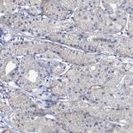 OLAH Antibody in Immunohistochemistry (IHC)