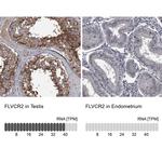 FLVCR2 Antibody in Immunohistochemistry (IHC)