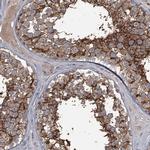 FLVCR2 Antibody in Immunohistochemistry (IHC)