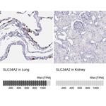 SLC34A2 Antibody in Immunohistochemistry (IHC)