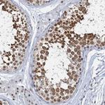 METTL14 Antibody in Immunohistochemistry (IHC)