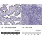 DYDC2 Antibody in Immunohistochemistry (IHC)