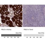 PBLD Antibody in Immunohistochemistry (IHC)